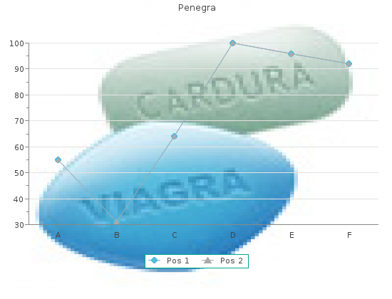 purchase penegra 50 mg on line